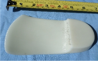 Backside of 3D Printed Orthotic