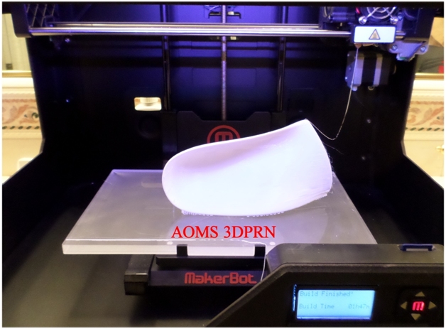 Sharp Shape AOMS 3DPRN Orthotic Printing 1