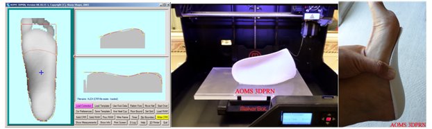 Sharp Shape AOMS 3DPRN Orthotic Printing Image